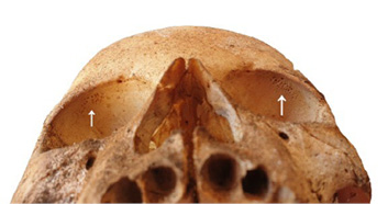 Fig6.tif