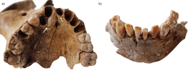 Fig3.tif
