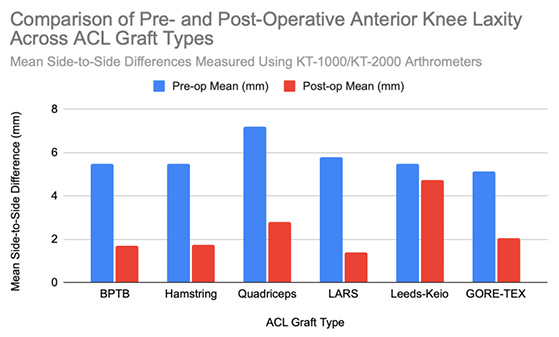 A clustered vertical bar chart shows blue pre-operative and red post-operative side-to-side knee laxity in millimeters for six graft types: BPTB, Hamstring, Quadriceps, LARS, Leeds-Keio, and GORE-TEX.
Each graft type has two adjacent bars – one for pre-op (blue), one for post-op (red) values.
Pre-operative bars are all high, between about 5 and 7 mm, indicating significant instability before surgery.
Post-operative bars are shorter: BPTB ≈ 1.7 mm, Hamstring ≈ 1.75 mm, Quadriceps ≈ 2.8 mm, LARS ≈ 1.4 mm, Leeds-Keio ≈ 4.75 mm, and GORE-TEX ≈ 2.05 mm.
The visual contrast shows large reductions in laxity for most grafts, with Leeds-Keio remaining visibly higher than the others.