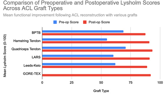 A horizontal bar chart is titled “Comparison of Preoperative and Postoperative Lysholm Scores Across ACL Graft Types”.
The vertical axis lists six graft types from top to bottom: BPTB, Hamstring Tendon, Quadriceps Tendon, LARS, Leeds-Keio, and GORE-TEX.
The horizontal axis shows Lysholm scores from 0 to 100.
Each graft type has two horizontal bars: a blue bar for the pre-operative score and a red bar for the post-operative score.
Blue bars are shorter for all grafts, ranging roughly from 55 to 71.
Red bars extend further right, between 87 and 93 points.
The GORE-TEX graft has only one red bar (with no blue pre-operative bar shown).
All grafts display visibly longer red bars, illustrating functional improvement after reconstruction.