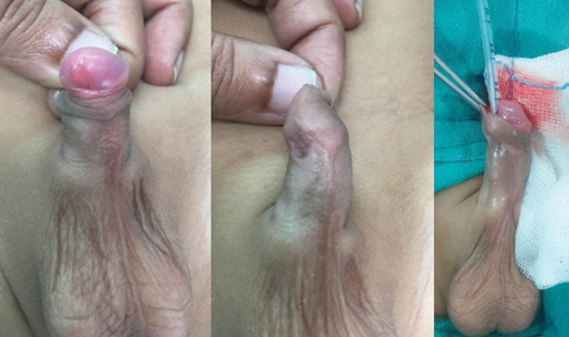 A person with a red mark on their finger.
Description generated by AI